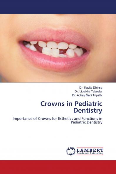 Crowns in Pediatric Dentistry