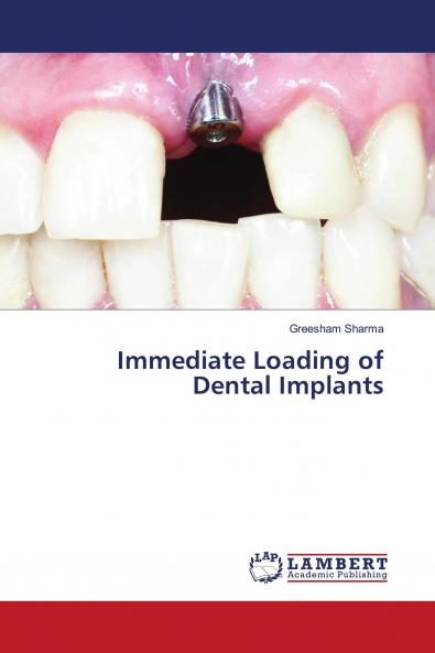 Immediate Loading of Dental Implants