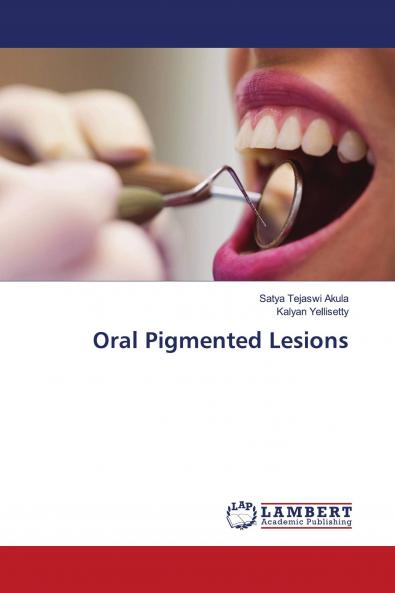 Oral Pigmented Lesions