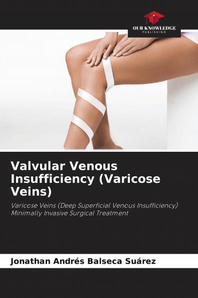 Valvular Venous Insufficiency (Varicose Veins)