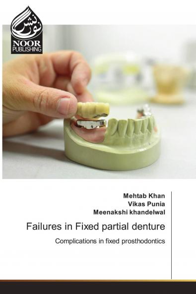 Failures in Fixed partial denture