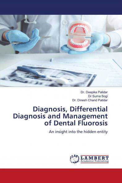 Diagnosis Differential Diagnosis and Management of Dental Fluorosis