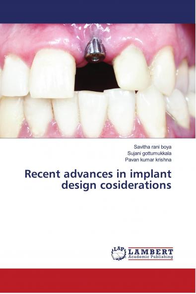 Recent advances in implant design cosiderations