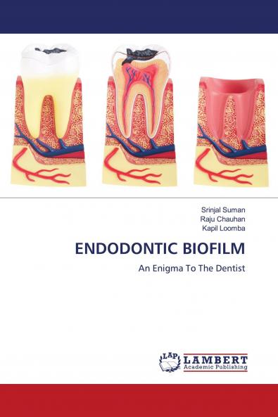 ENDODONTIC BIOFILM