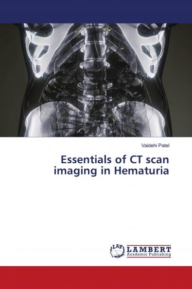 Essentials of CT scan imaging in Hematuria