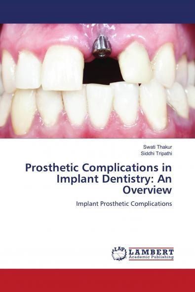 Prosthetic Complications in Implant Dentistry: An Overview