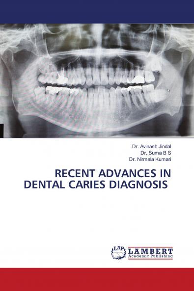 RECENT ADVANCES IN DENTAL CARIES DIAGNOSIS