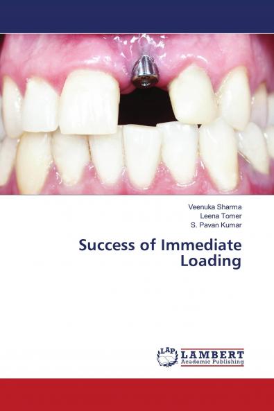 Success of Immediate Loading