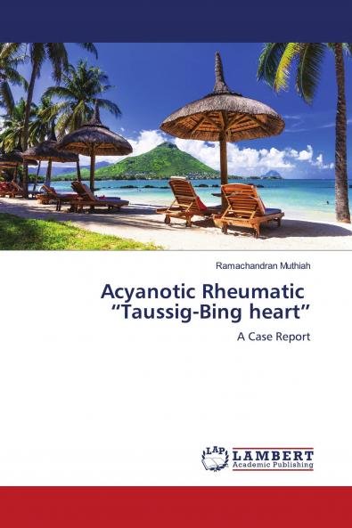 Acyanotic Rheumatic ���Taussig-Bing heart���