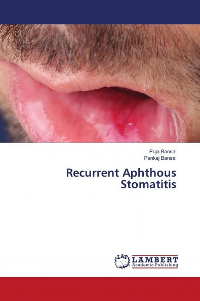 Recurrent Aphthous Stomatitis