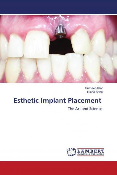 Esthetic Implant Placement