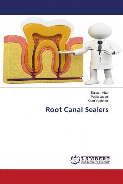 Root Canal Sealers