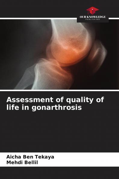 Assessment of quality of life in gonarthrosis