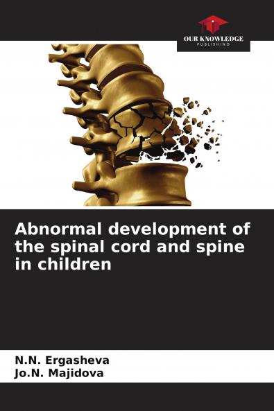 Abnormal development of the spinal cord and spine in children