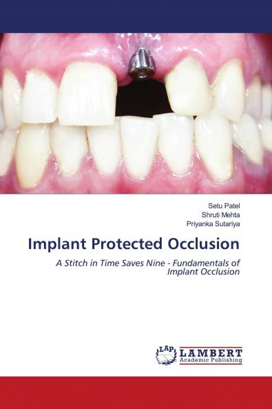 Implant Protected Occlusion