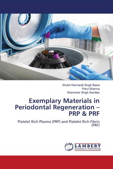 Exemplary Materials in Periodontal Regeneration ��� PRP & PRF