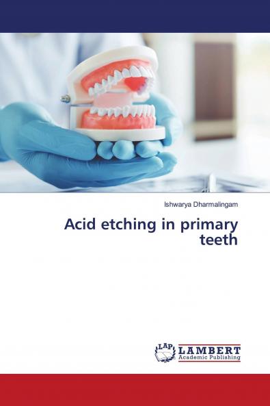 Acid etching in primary teeth