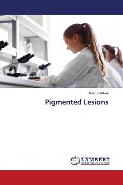 Pigmented Lesions