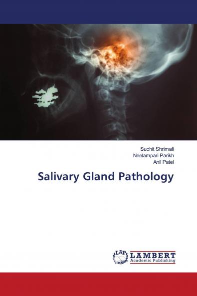 Salivary Gland Pathology