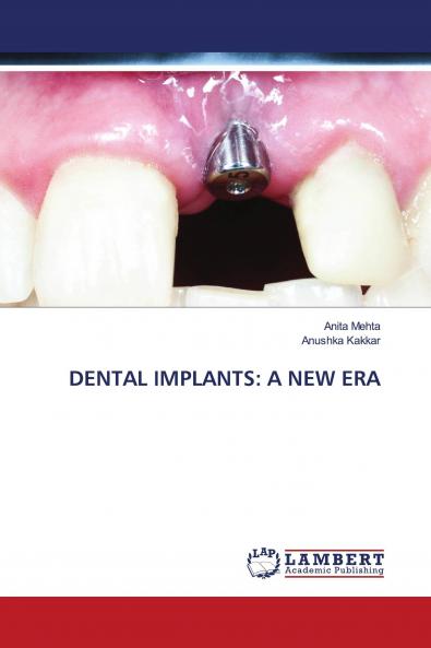 DENTAL IMPLANTS: A NEW ERA