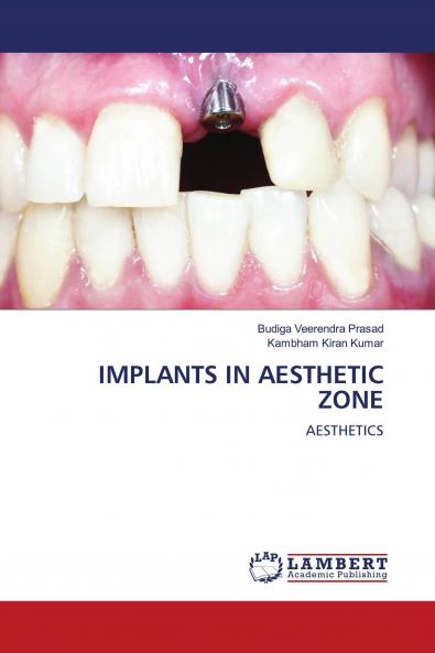 IMPLANTS IN AESTHETIC ZONE