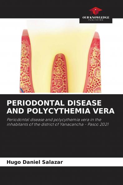 PERIODONTAL DISEASE AND POLYCYTHEMIA VERA