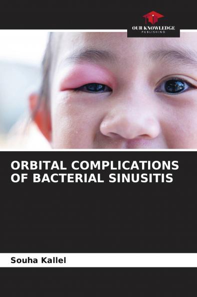 ORBITAL COMPLICATIONS OF BACTERIAL SINUSITIS