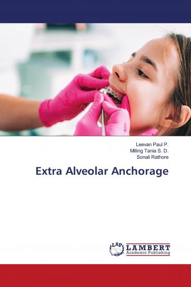 Extra Alveolar Anchorage