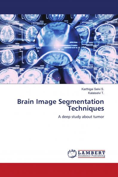 Brain Image Segmentation Techniques