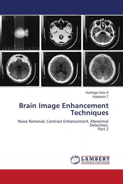 Brain Image Enhancement Techniques