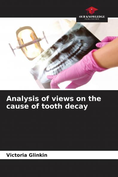 Analysis of views on the cause of tooth decay