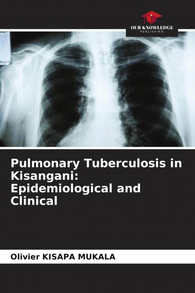 Pulmonary Tuberculosis in Kisangani