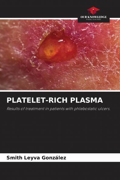 PLATELET-RICH PLASMA