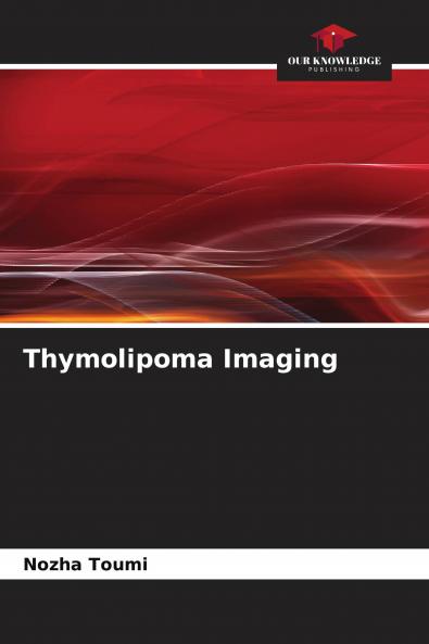 Thymolipoma Imaging