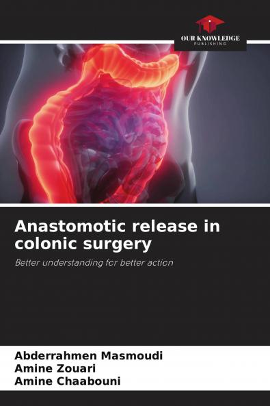 Anastomotic release in colonic surgery