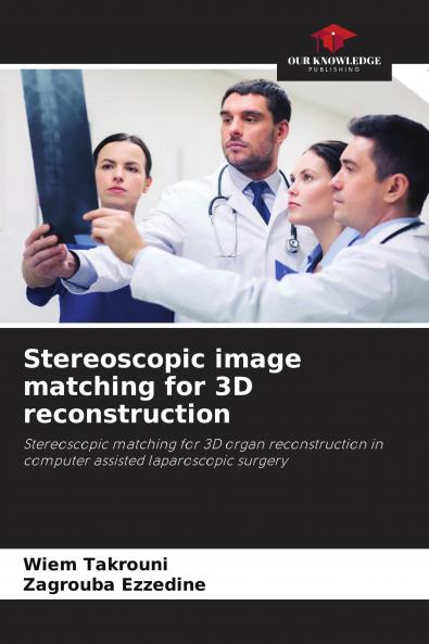 Stereoscopic image matching for 3D reconstruction