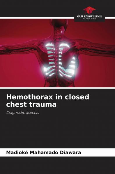 Hemothorax in closed chest trauma