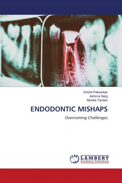 ENDODONTIC MISHAPS