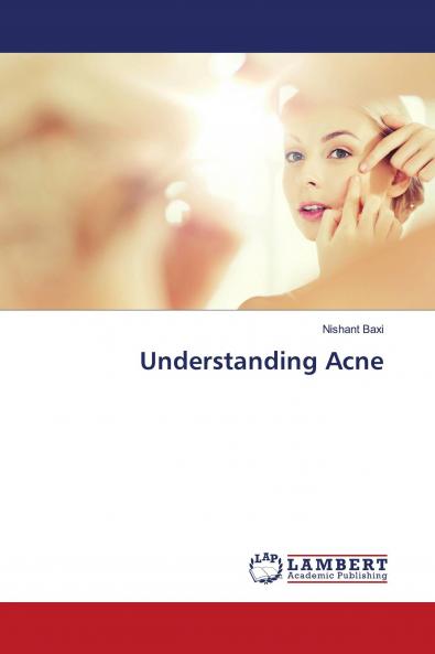 Understanding Acne