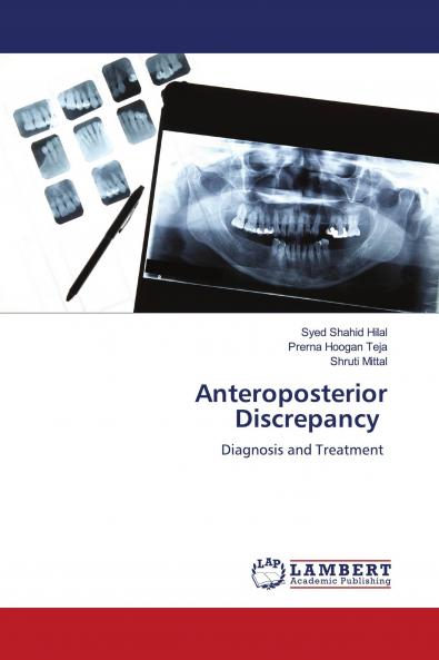 Anteroposterior Discrepancy