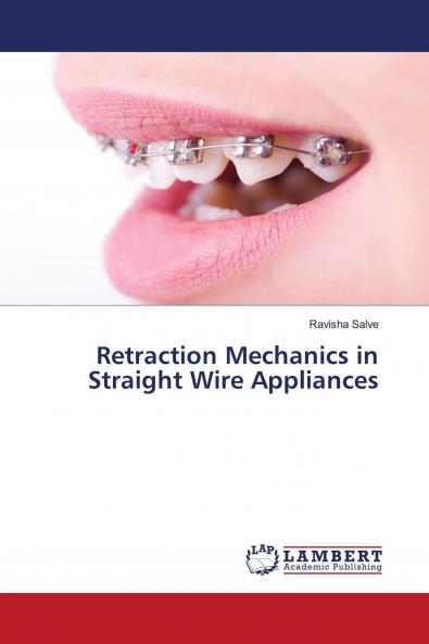 Retraction Mechanics in Straight Wire Appliances
