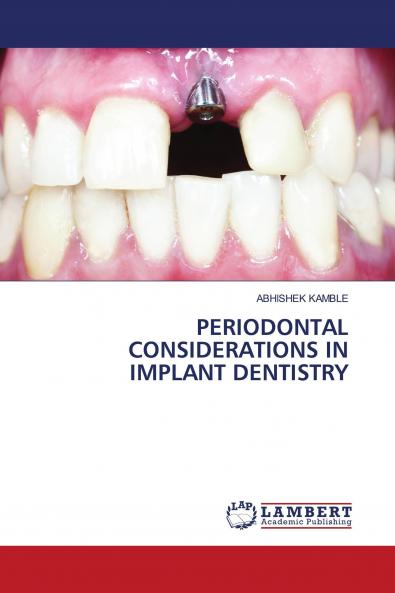 PERIODONTAL CONSIDERATIONS IN IMPLANT DENTISTRY