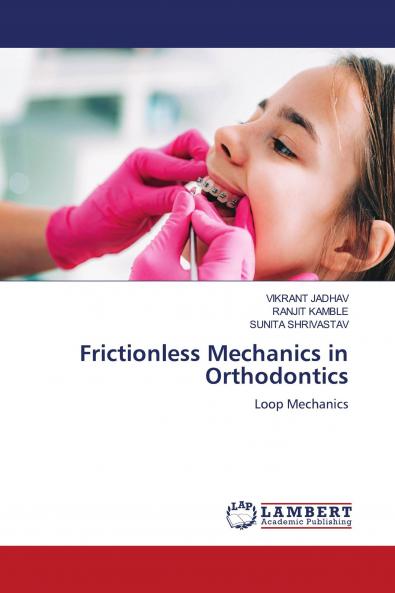 Frictionless Mechanics in Orthodontics