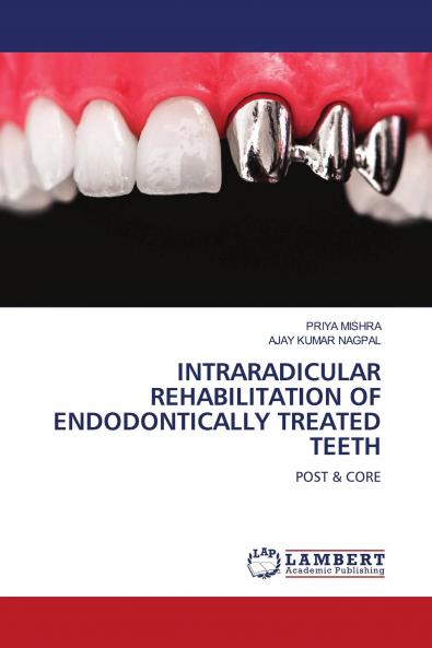 INTRARADICULAR REHABILITATION OF ENDODONTICALLY TREATED TEETH