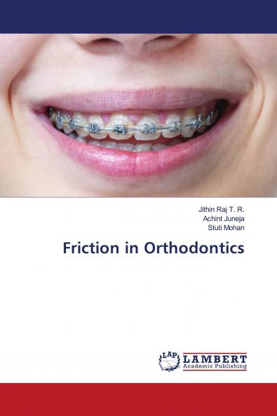 Friction in Orthodontics