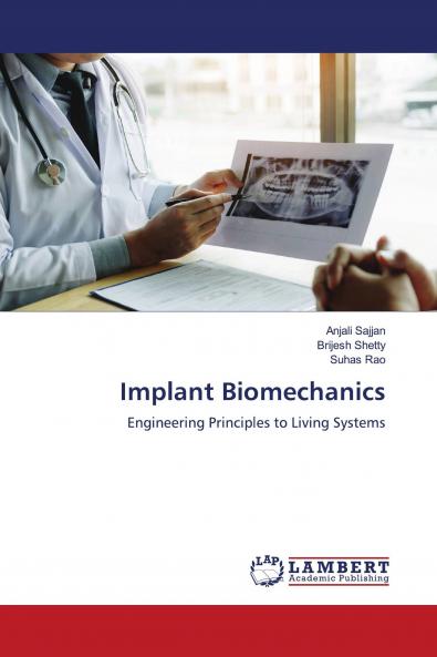 Implant Biomechanics