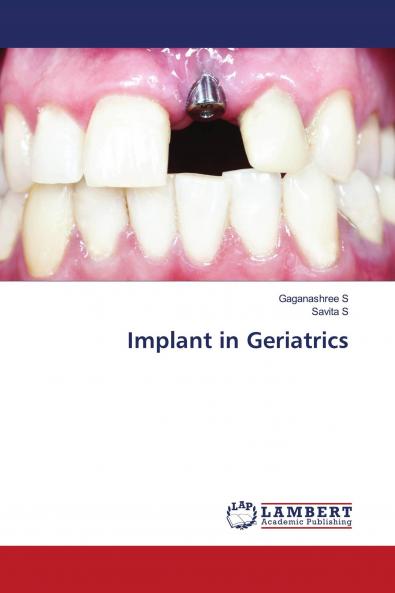Implant in Geriatrics