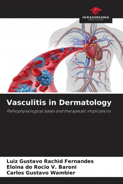 Vasculitis in Dermatology