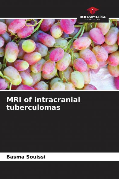 MRI of intracranial tuberculomas