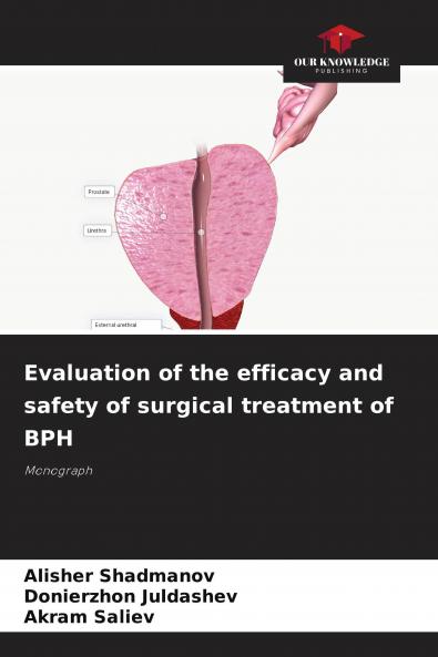 Evaluation of the efficacy and safety of surgical treatment of BPH